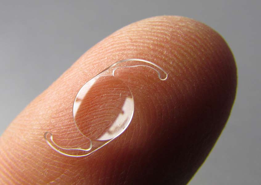 Refractive Lens Exchange - RLE
